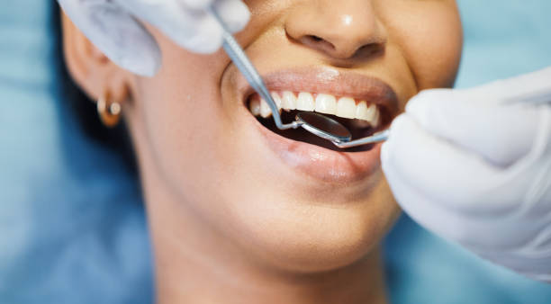 Best Emergency Broken Tooth Repair in West Valley City, UT